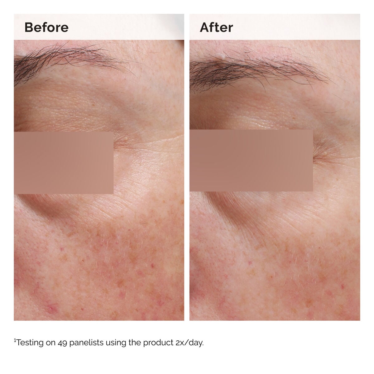 niacinamide-5-face-and-body-emulsion-v5 2024-08-23-ORD-Nia-5pct-Face-Body-B-A-Elasticity-Global-02-1x1.jpg