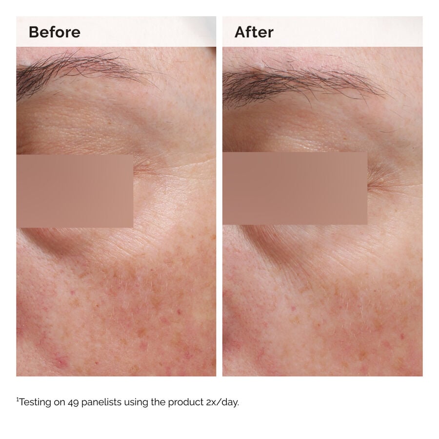 niacinamide-5-face-and-body-emulsion-z0 2024-08-23-ORD-Nia-5pct-Face-Body-B-A-Elasticity-Global-02-1x1.jpg