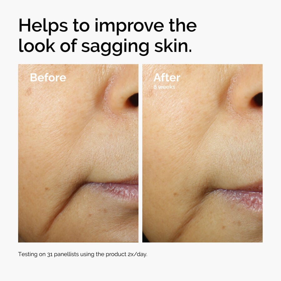 caffeine-3-escin-1-face-serum-v6 ord-caffeine-3pct-escin-1pct-face-serum-before-after-sagging.jpg