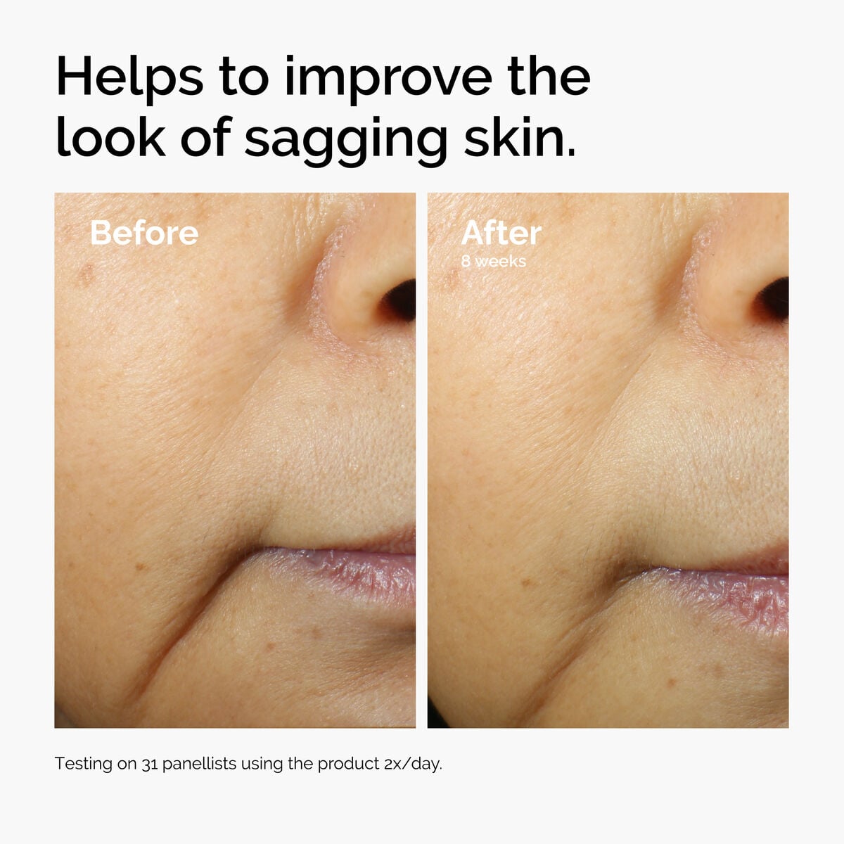 caffeine-3-escin-1-face-serum-v6 ord-caffeine-3pct-escin-1pct-face-serum-before-after-sagging.jpg