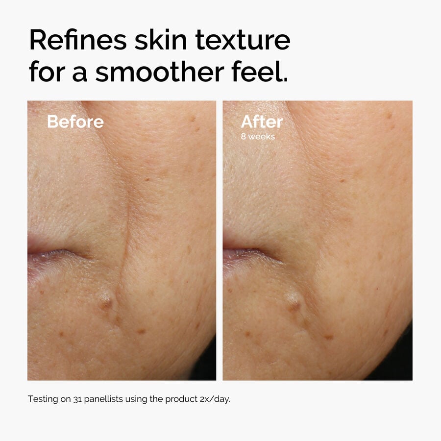 caffeine-3-escin-1-face-serum-v6 ord-caffeine-3pct-escin-1pct-face-serum-before-after-texture.jpg