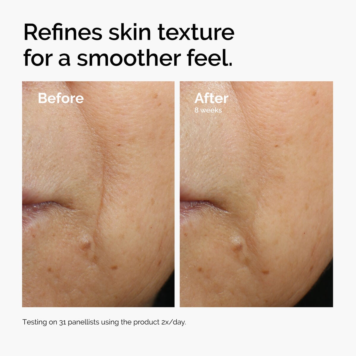 caffeine-3-escin-1-face-serum-v6 ord-caffeine-3pct-escin-1pct-face-serum-before-after-texture.jpg