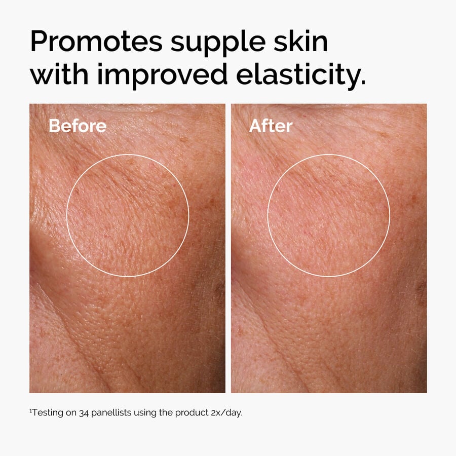 hyaluronic-acid-2-b5-with-ceramides-t7 ord-hyaluronic-acid-2pct-b5-hydrating-serum-before-after-elasticity.jpg