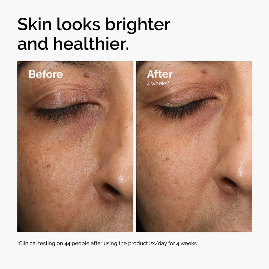 multi-antioxidant-radiance-serum-a6 ord-mars-before-after-healthy.jpg
