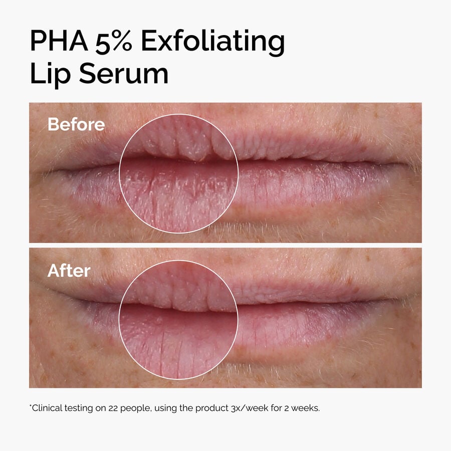 pha-5-exfoliating-lip-serum-y1 ord-pha-5pct-lip-exfoliating-serum-before-after.jpg