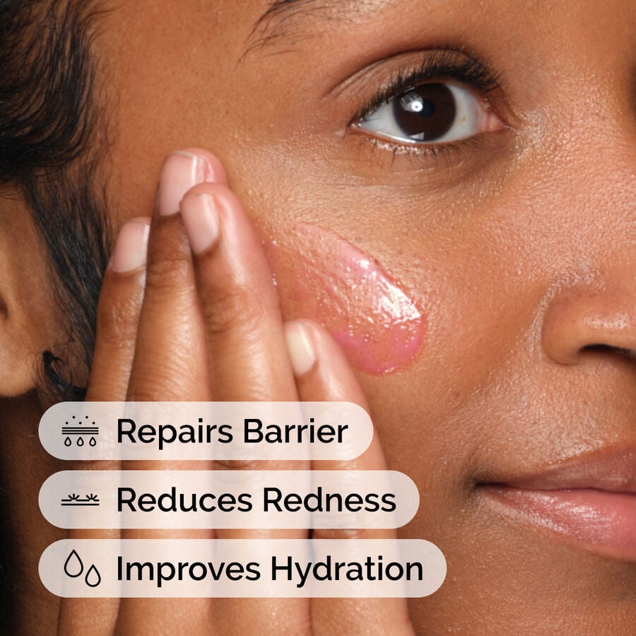 soothing-and-barrier-support-serum-set-e9 ord-soothing-barrier-support-serum-model-application-with-benefits.jpg